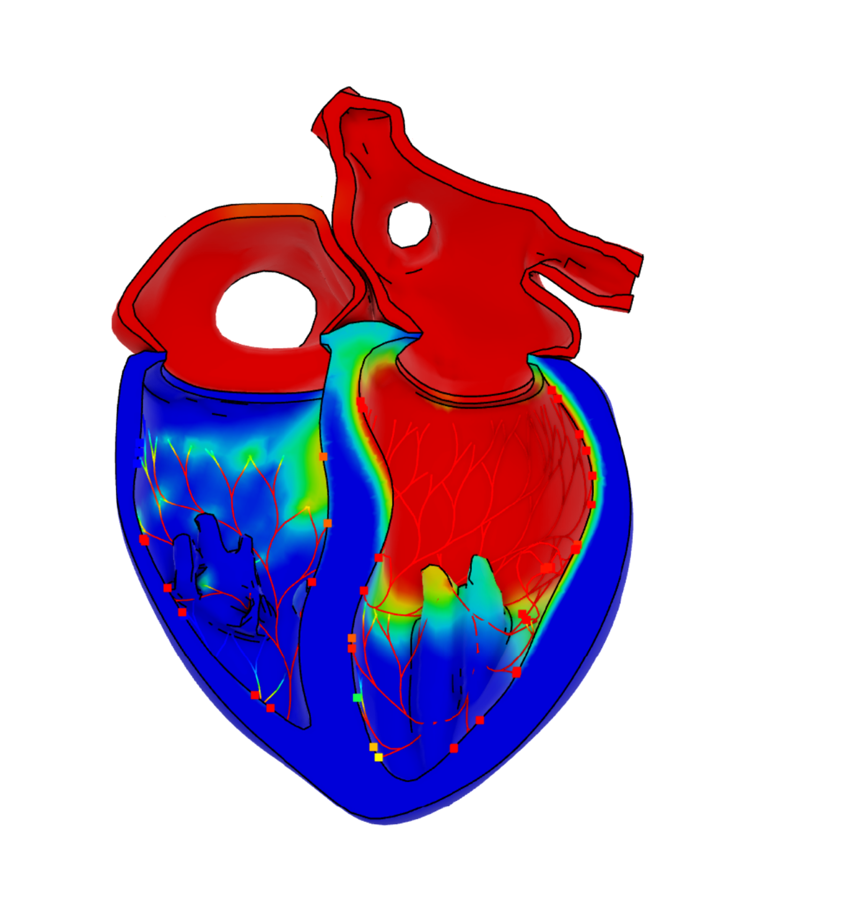 Living Heart > Dassault Systèmes